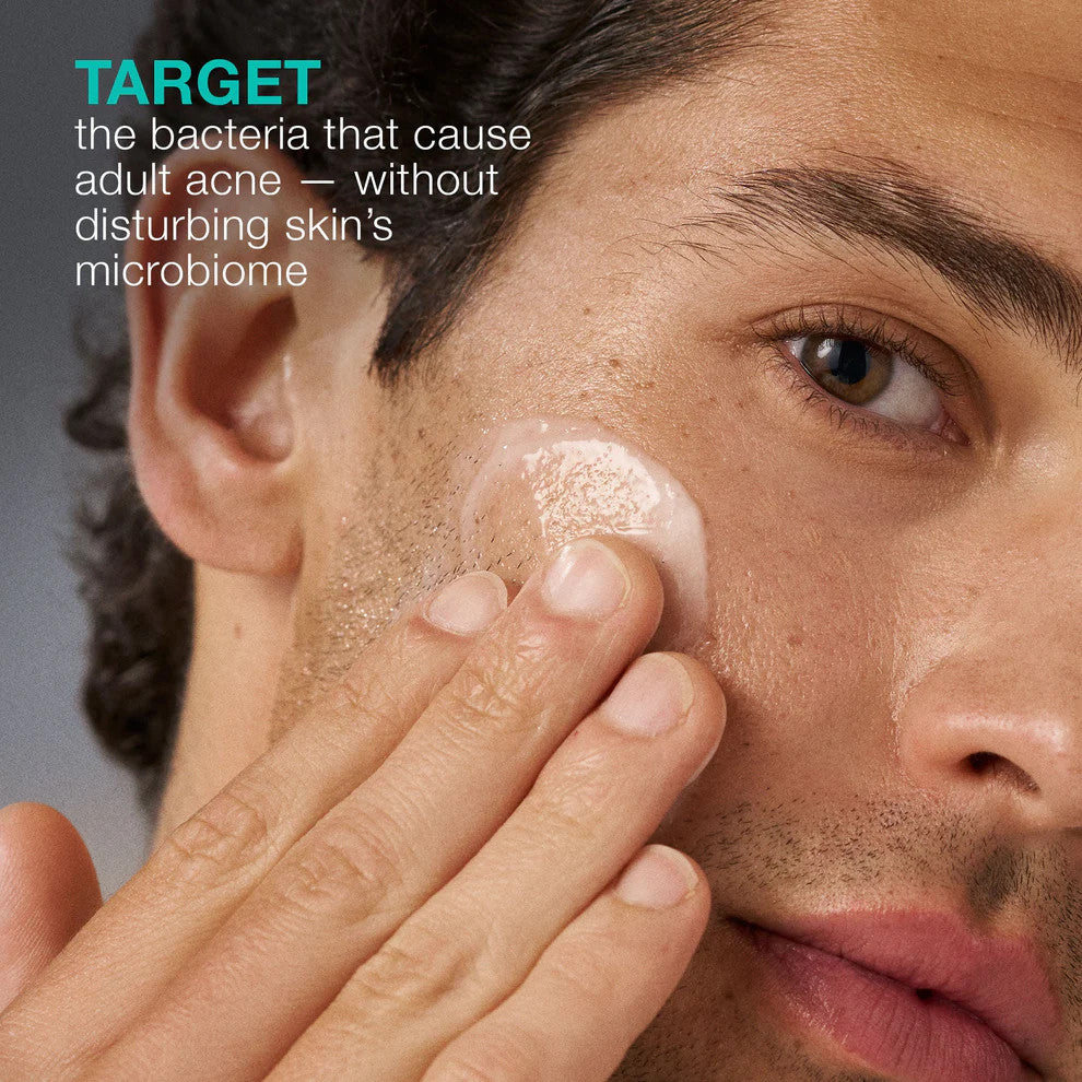 acne biotic moisturizer