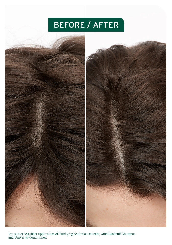 Scalp Sync Anti-Dandruff Shampoo