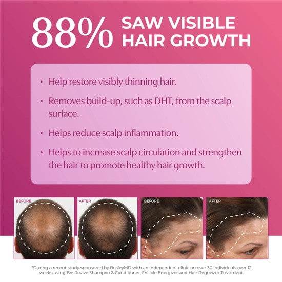 Womens Hair Re-growth Treatment 2% Dropper