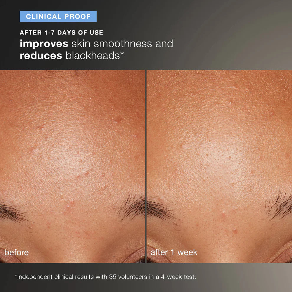 daily microfoliant exfoliator
