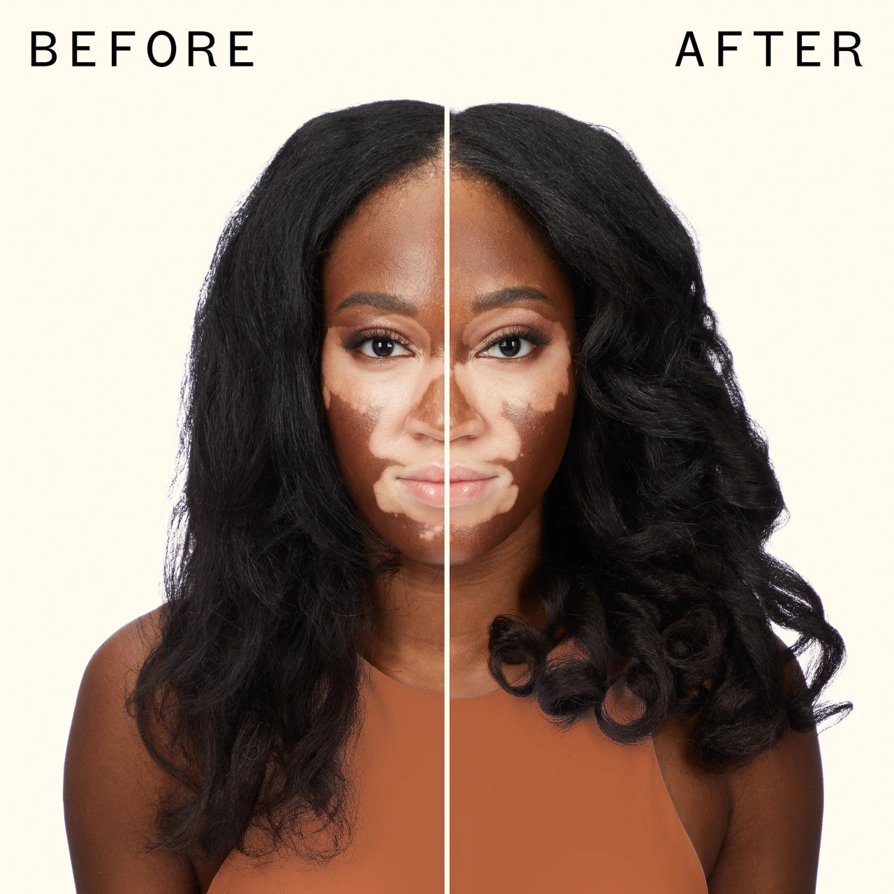 blockade heat serum