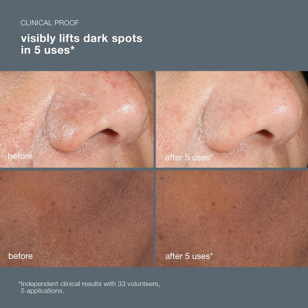 powerbright dark spot peel