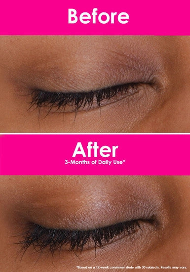 GrandeLASH-MD Lash Enhancing Serum