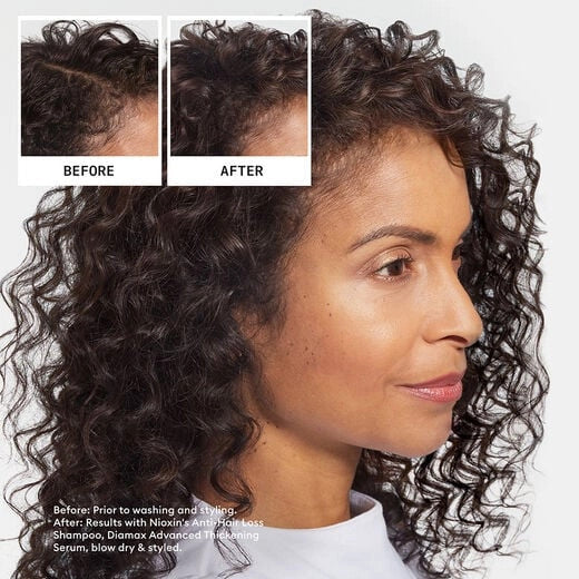 Hair Fall Defense Shampoo